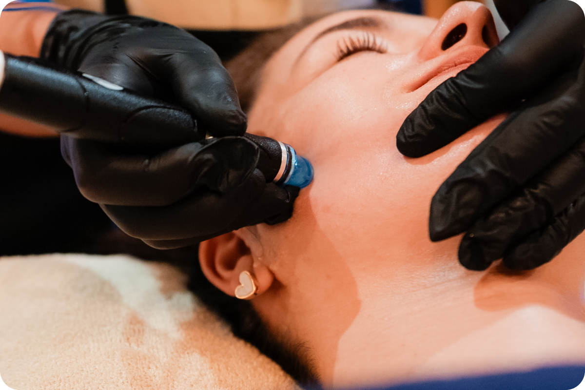 Nettoyage de la peau lors d'un soin HydraFacial à la Clinique de L'Impératrice à Rennes