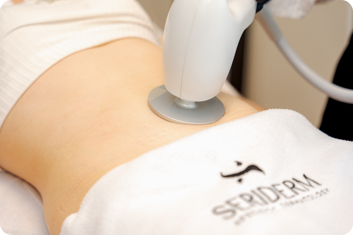 Soin du corps par body contouring à la Clinique de L'Impératrice à Rennes